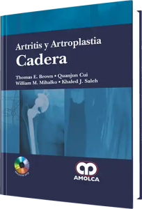Artritis y Artroplastia Cadera. Incluye DVD