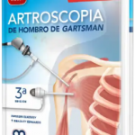 Artroscopia de Hombro de Gartsman