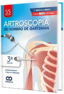 Artroscopia de Hombro de Gartsman
