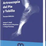 Artroscopía del Pie y Tobillo