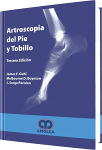 Artroscopía del Pie y Tobillo