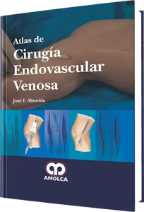 Atlas de Cirugía Endovascular Venosa