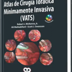 Atlas de Cirugía Torácica Mínimamente Invasiva (VATS)
