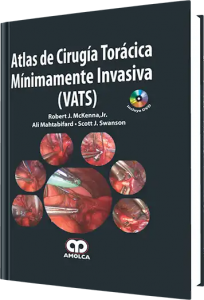 Atlas de Cirugía Torácica Mínimamente Invasiva (VATS)