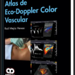 Atlas de Eco-Doppler Color Vascular