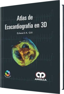 Atlas de Ecocardiografía en 3D