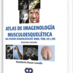 Atlas de Imagenología Musculoesquelética. 200 Signos Radiológicos:RMN, TEM, US y RX. 2da Edición