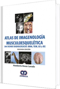 Atlas de Imagenología Musculoesquelética. 200 Signos Radiológicos:RMN, TEM, US y RX. 2da Edición