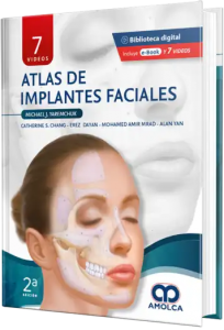 Atlas de Implantes Faciales. Segunda Edición.