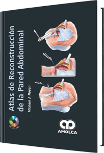 Atlas de Reconstrucción de la Pared Abdominal