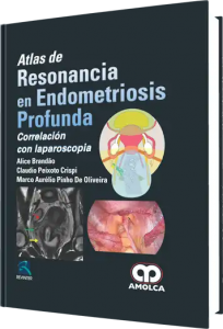 Atlas de Resonancia en Endometriosis Profunda