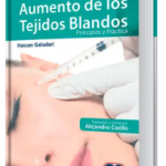 Aumento de Tejidos Blandos. Principios y Práctica.