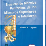 Bloqueos de Nervios Periféricos.