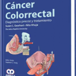 Cáncer Colorrectal