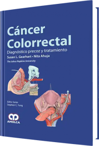 Cáncer Colorrectal