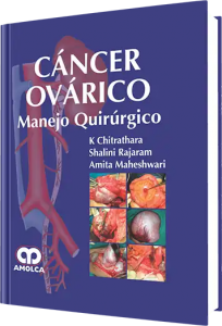 Cáncer Ovárico Manejo Quirúrgico