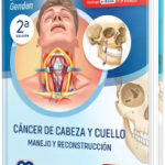 Cáncer de Cabeza y Cuello. Manejo y Reconstrucción. 2da Edición.
