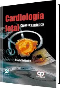 Cardiología Fetal