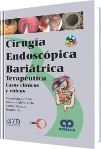 Cirugía Endoscópica Bariátrica. Terapéutica, casos clínicos y videos