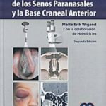 Cirugía Endoscópica de los Senos Paranasales