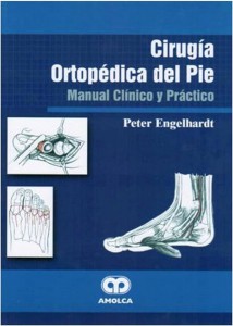 Cirugía Ortopédica del Pie