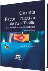 Cirugía Reconstructiva de Pie y Tobillo Manejo de Complicaciones.