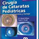 Cirugía de Cataratas Pediátricas. Segunda Edición.
