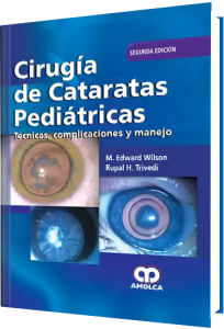 Cirugía de Cataratas Pediátricas. Segunda Edición.