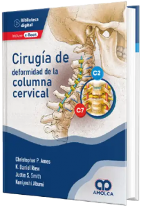 Cirugía de Deformidad de la Columna Cervical.