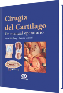 Cirugía del Cartílago.