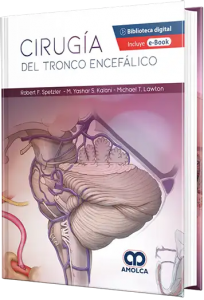 Cirugía del tronco encefálico