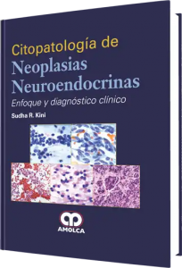 Citopatología de Neoplasias Neuroendocrinas