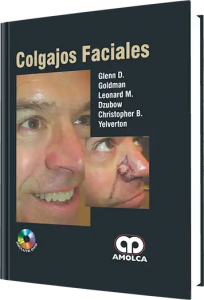 Colgajos Faciales