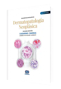 Dermatopatología Neoplásica. Segunda Edición.