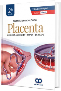 Diagnóstico Patológico.  Placenta. 2da Edición