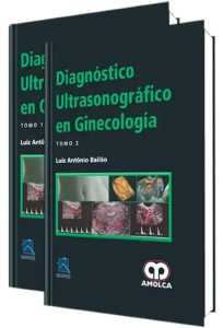 Diagnóstico Ultrasonográfico en Ginecología. Tomos I - II