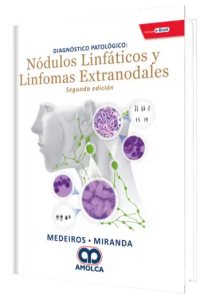 Diagnósticos Patológicos Nódulos Linfáticos y Linfomas Extranodales. 2da Edición