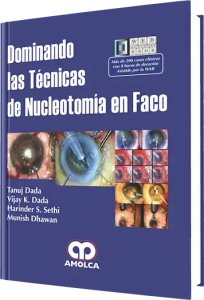Dominando las Técnicas de Nucleotomía en FACO.