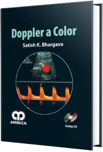 Doppler a Color.