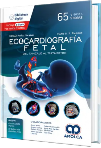 Ecocardiografía fetal