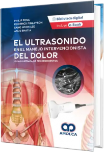 El ultrasonido en el manejo intervencionista del dolor