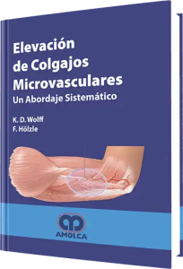 Elevación de Colgajos Microvasculares