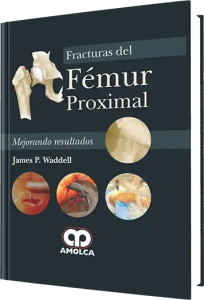 Fracturas del Fémur Proximal